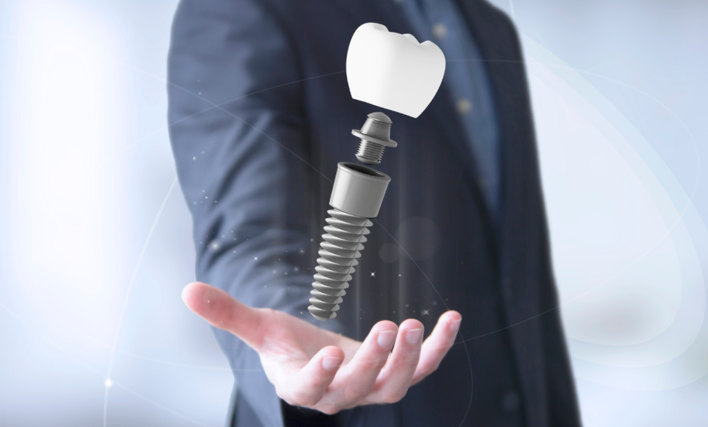 dental_implants_Johnson_City_dentist