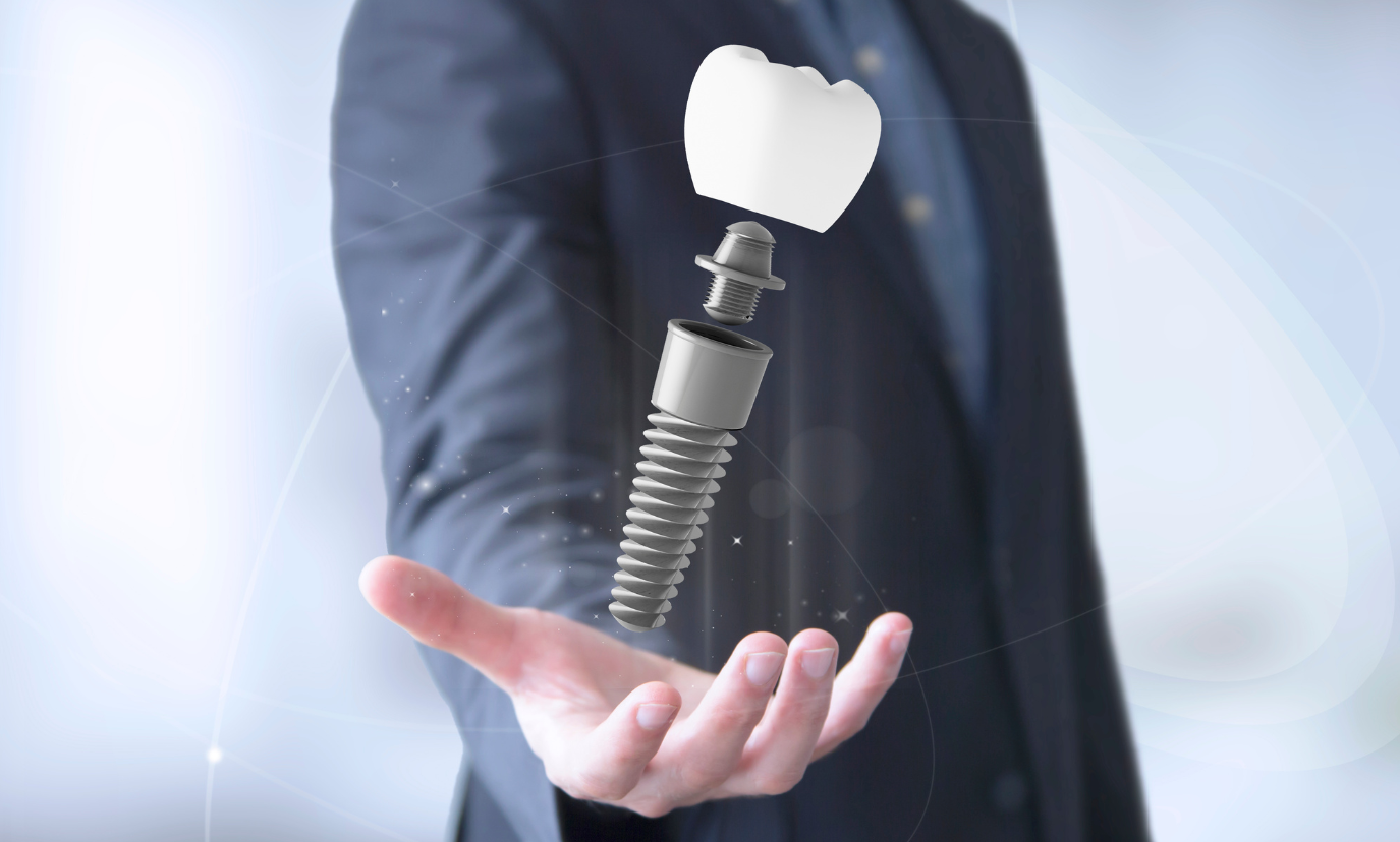 dental_implants_Johnson_City_dentist